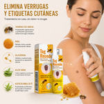 Te Elimina Verrugas Sin Dolor ni Cirugía - Tag Recede Spray