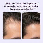 Crece tu cabello fuerte y saludable en 7 días - Spray de Jengibre King of Ginger