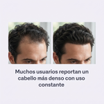 Recupera la densidad y fuerza de tu cabello con Minoxidil 5% - Zamia Minoxidil Spray Original