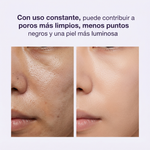 Limpia los Poros y Elimina el Acné - Espátula Facial Ultrasónica 3 en 1
