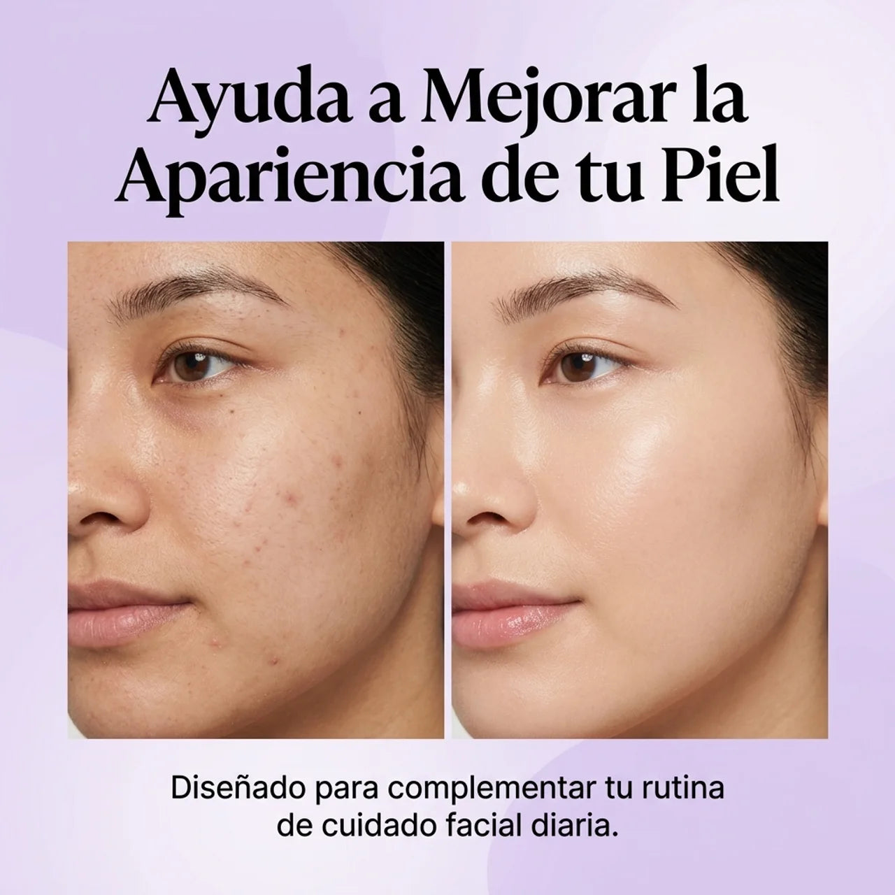 Rejuvenece tu Piel con Fototerapia LED - Máscara Facial 7 Colores