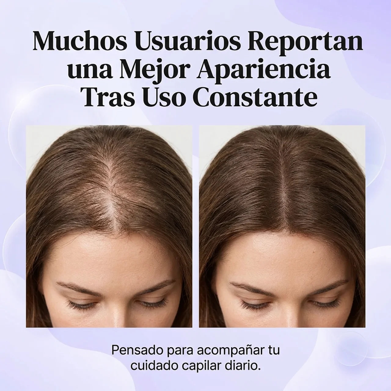 Estimula el Crecimiento Capilar con Luz y Vibración - Cepillo TTT