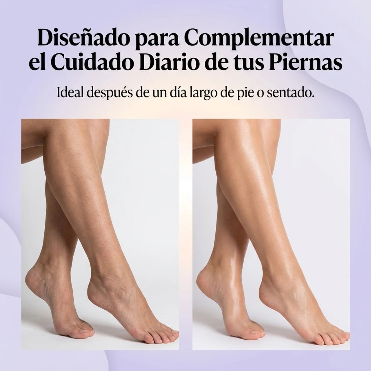 Hidrata y Cuida las Piernas Cansadas - Varicose Veins Spray