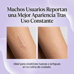 Suaviza y Aplana las Cicatrices - Spray South Moon X2