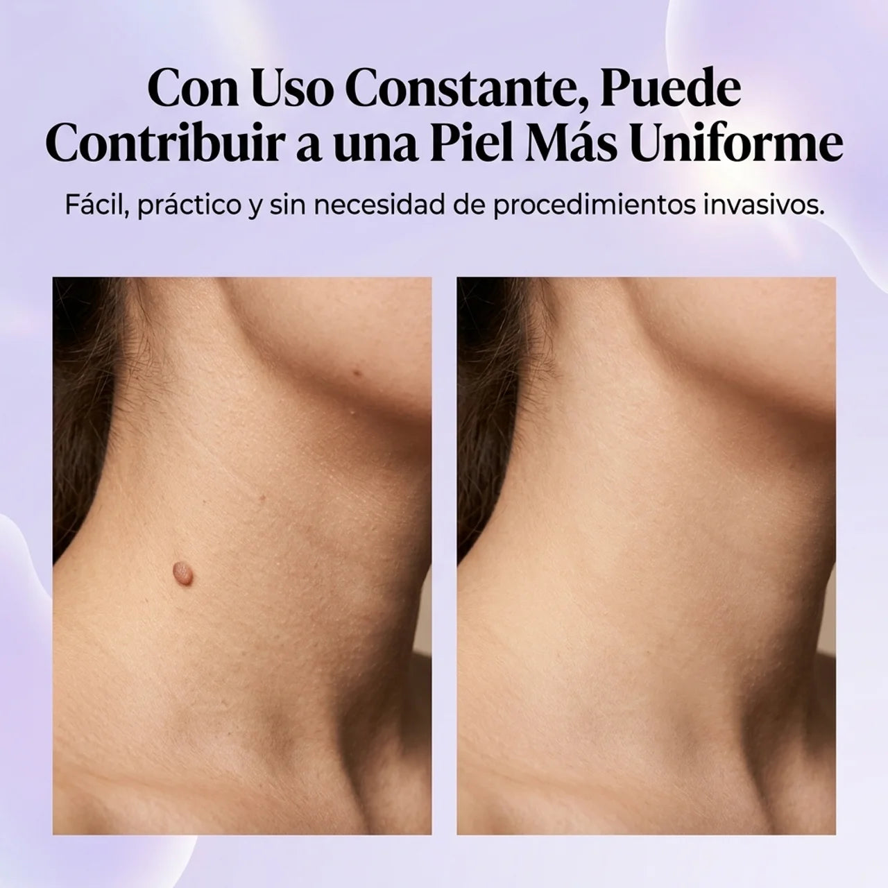 Elimina Verrugas Sin Dolor ni Cirugía - Tag Recede Spray