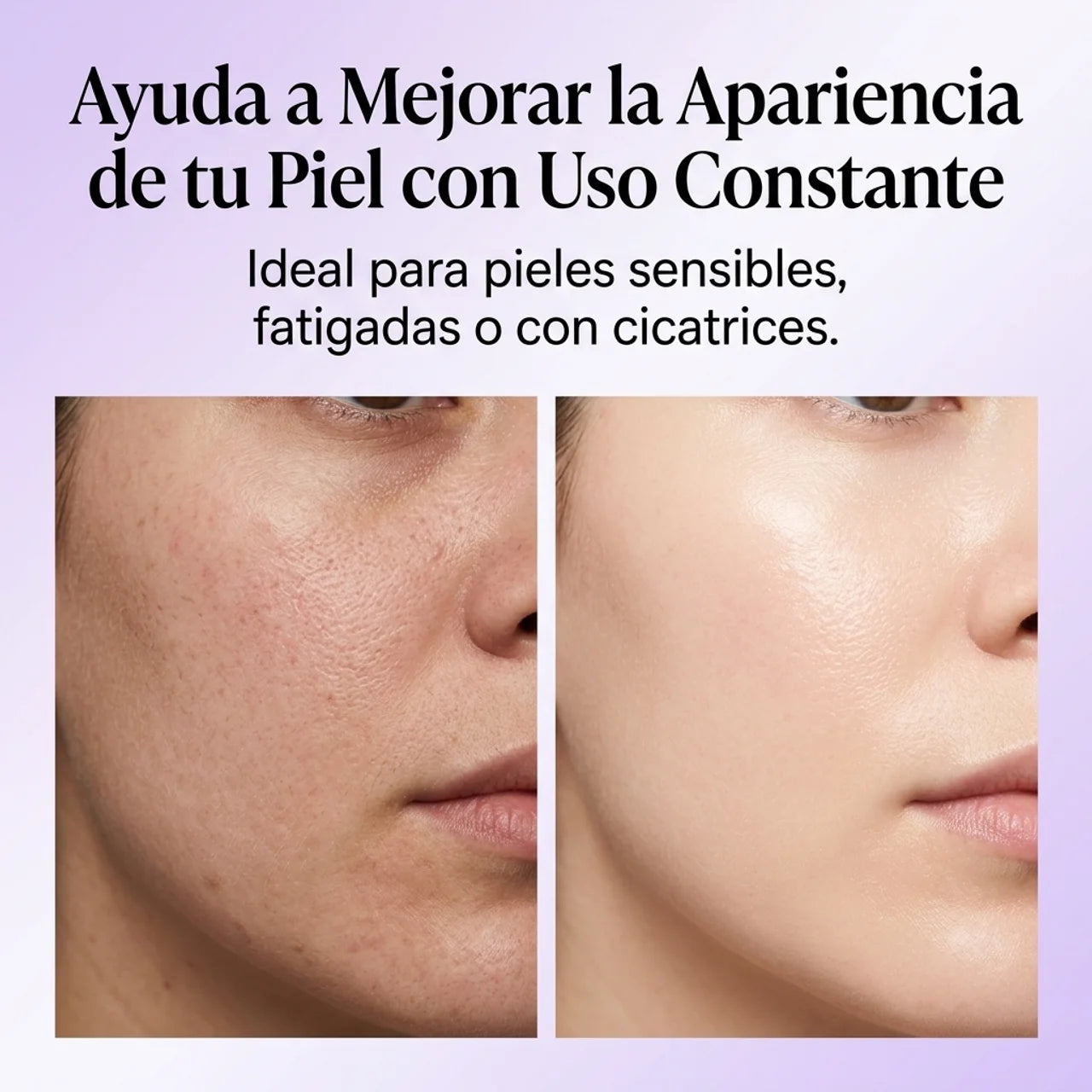 Renueva la Piel con Veneno de Abeja - Bee Venom BsWell
